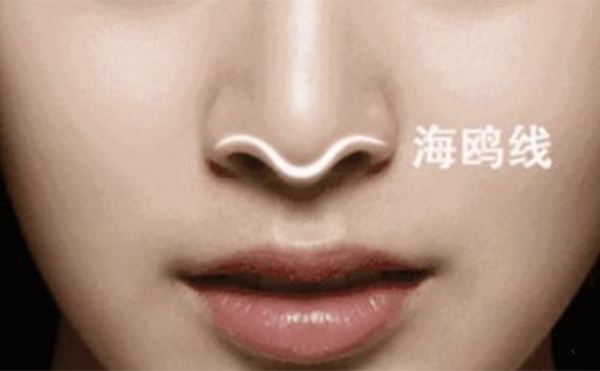 僅僅是對(duì)假體的形狀不滿意可以直接把原來(lái)的假體修好再放進(jìn)去嗎?