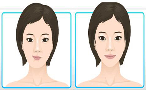 這些小習慣時間長了會導(dǎo)致面部不對稱，快看看你有沒有