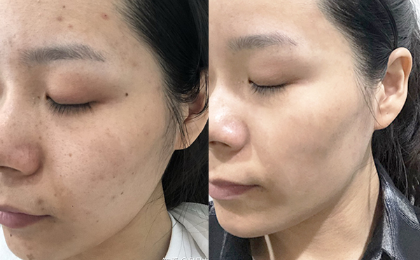 白瓷娃娃疼嗎？