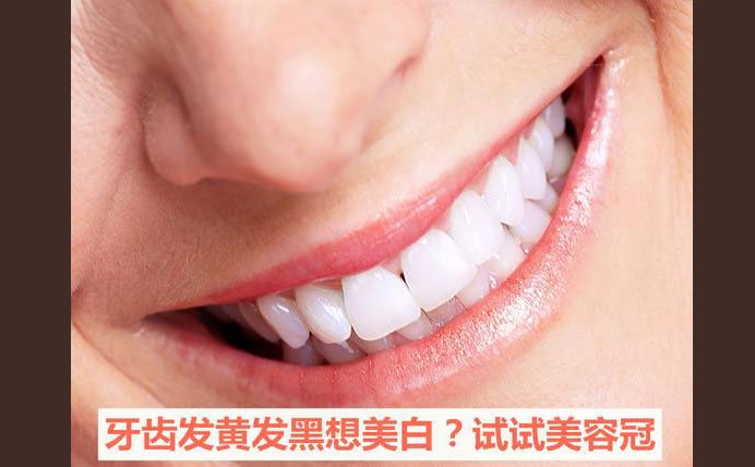 牙齒美容冠大約多少錢(qián)？牙齒美容冠怎么做的？