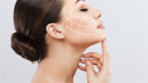 玻尿酸去法令紋