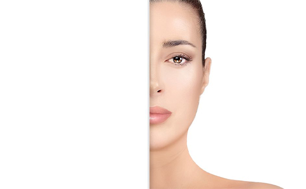 唐山金榮自體脂肪豐額頭有什么優(yōu)勢(shì)?自體脂肪豐額頭效果