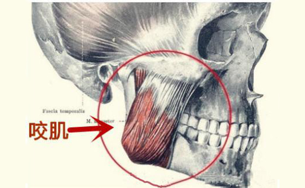 咬肌肥大不用怕，5招教你輕松瘦咬肌