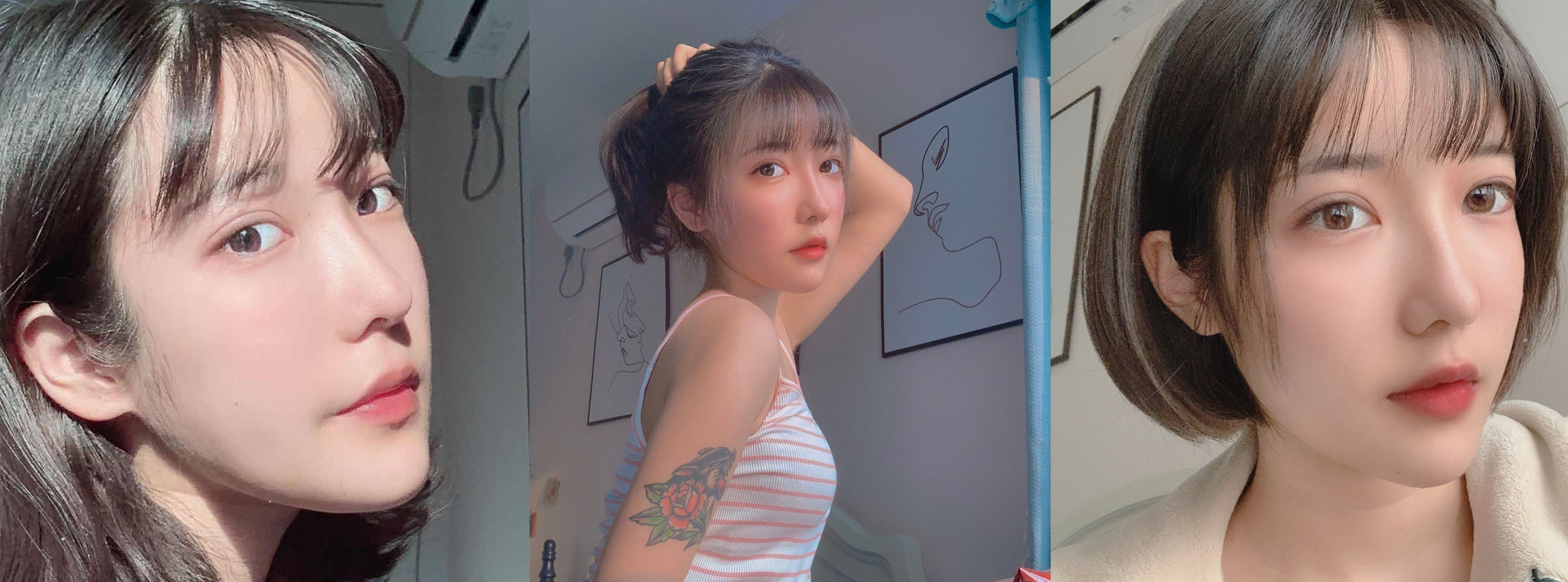 杭州時光自體脂肪填充效果圖2