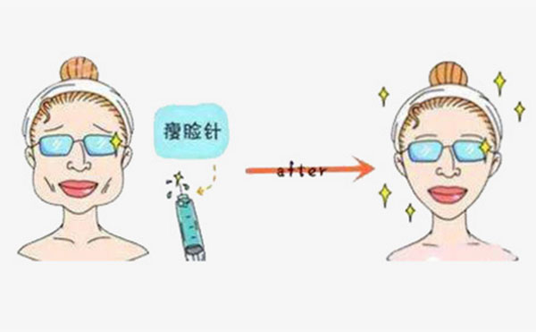 是否會(huì)對(duì)瘦臉針產(chǎn)生依賴(lài)?