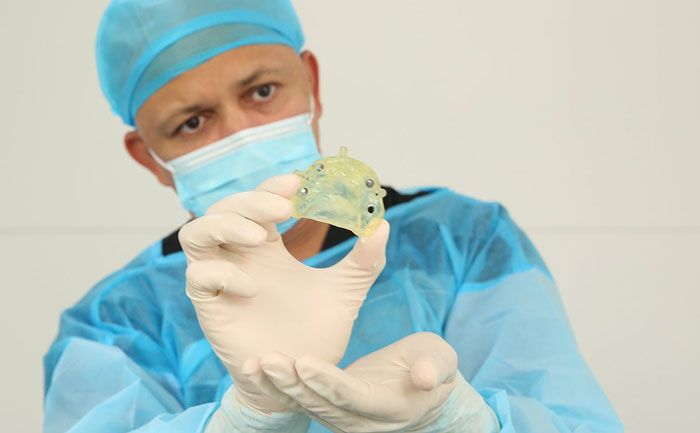 貴金屬烤瓷牙有哪些？貴金屬烤瓷牙的種類