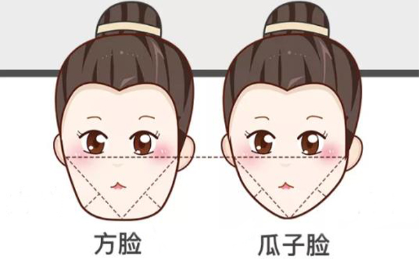 在沈陽伊美爾做下頜角整形有什么優(yōu)勢(shì)?