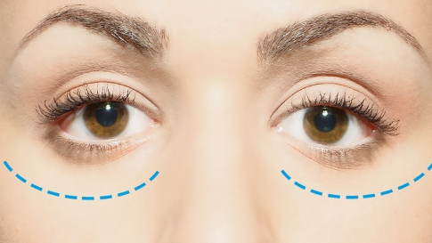 先天性突眼怎么辦？