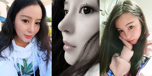 太原時(shí)光整形醫(yī)院案例2