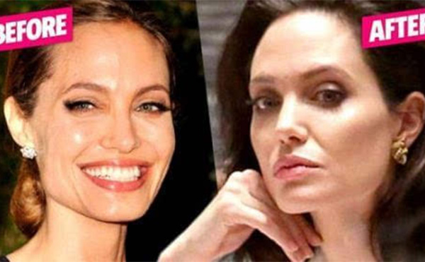 【整容教程篇】想要改善面部輪廓線條應(yīng)該從哪個部位下手?