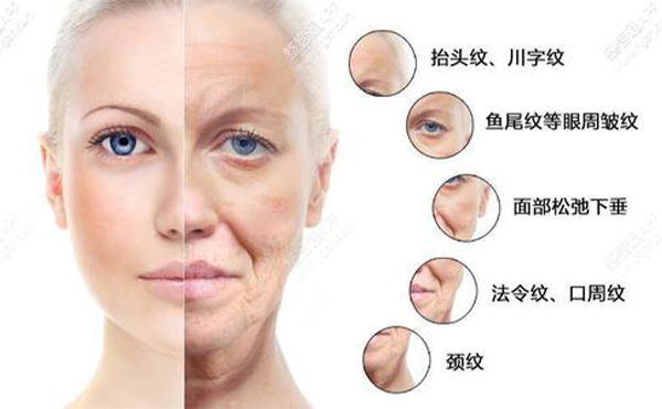 線雕的好處有哪些？