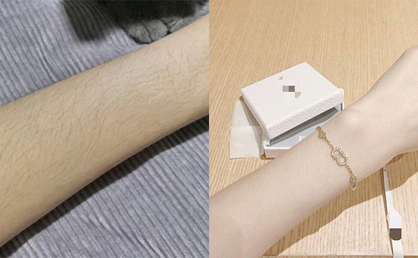 冰點手臂脫毛安全嗎