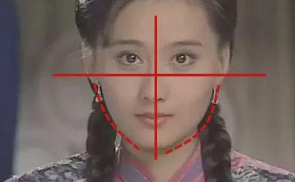 歪鼻矯正手術(shù)前后注意事項