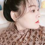 鼻基底整形案例對比5