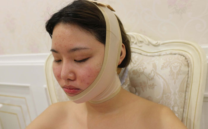 面部吸脂修復(fù)手術(shù)多少錢？面部吸脂會反彈嗎？