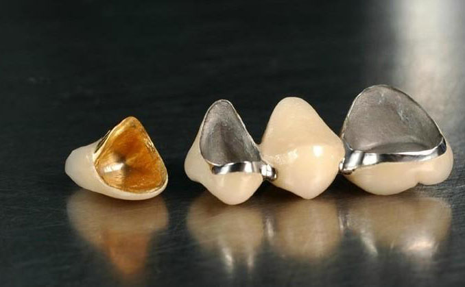 全瓷烤瓷牙多少錢一顆2021？全瓷牙可以用多久？