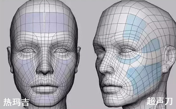 超聲刀跟熱瑪吉有什么區(qū)別?怎么選擇?