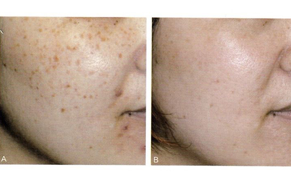 復(fù)合彩光效果怎么樣？