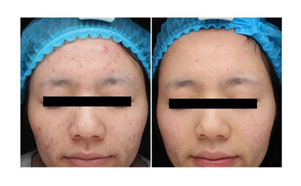 復(fù)合彩光安全嗎？