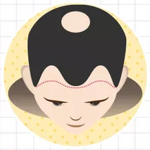 四級(jí)脫發(fā)