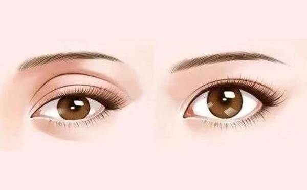 年輕人眼窩凹陷是什么原因?年輕人眼窩凹陷怎樣恢復(fù)?