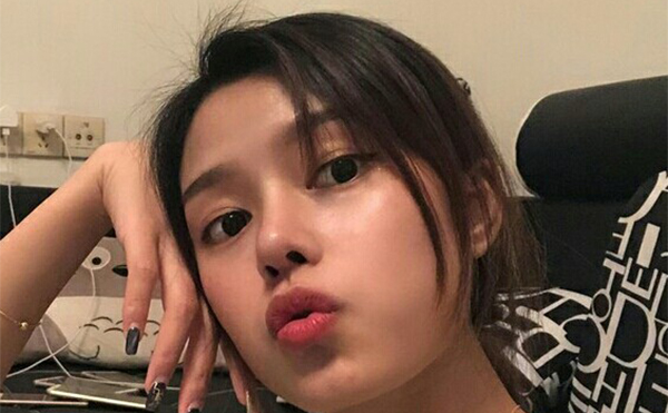 隆鼻術(shù)后兩個(gè)月