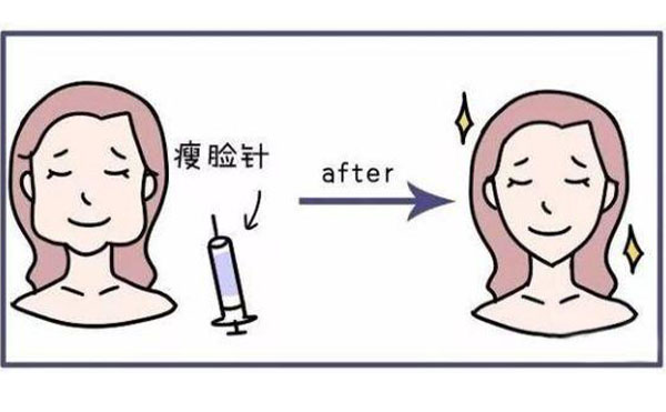 瘦臉針有什么功能？