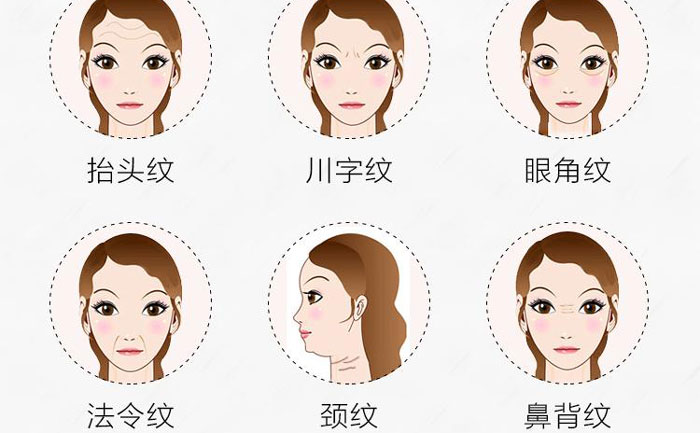 botox除皺針有哪些副作用？