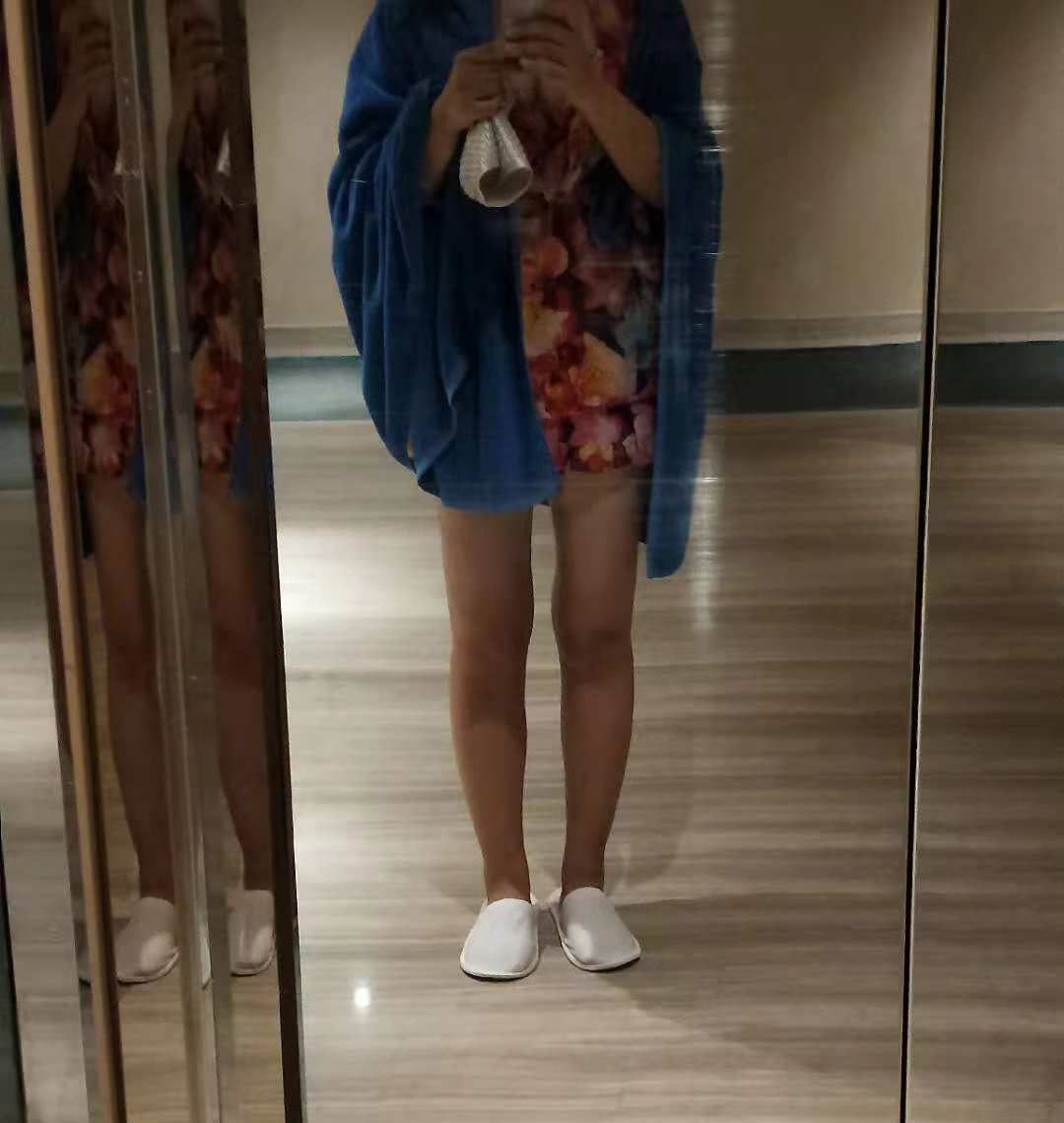 大腿吸脂手術效果圖4