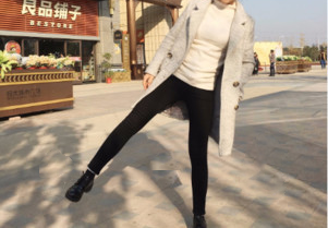 太原時(shí)光整形王國(guó)軍大腿吸脂案例4