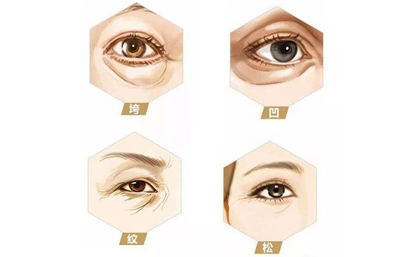 眼部凹陷是什么導致的?眼部凹陷怎么解決?