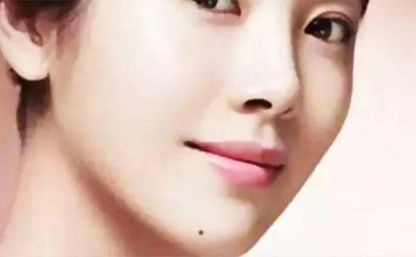 膨體隆下巴多少錢?口內切口會對牙齦造成損傷嗎?