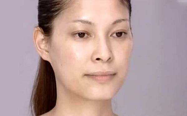 改臉型手術會不會有后遺癥?安全嗎?