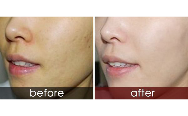 白瓷娃娃適合人群有哪些？