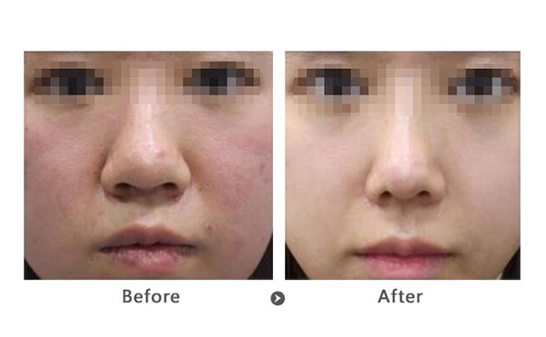 做黑臉娃娃前要注意什么？