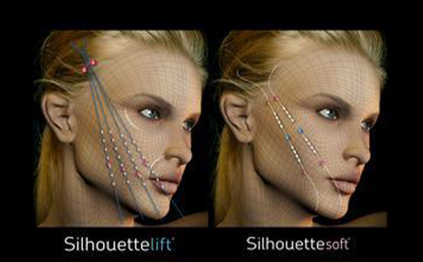 面部線雕后臉變形了是什么原因?還能恢復(fù)嗎?