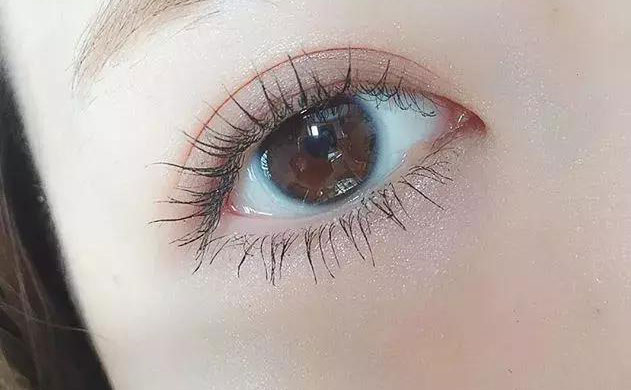 激光雙眼皮手術(shù)多少錢？激光雙眼皮手術(shù)需要多久恢復(fù)時(shí)間？