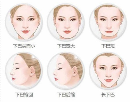 鄭州壹加壹假體下巴