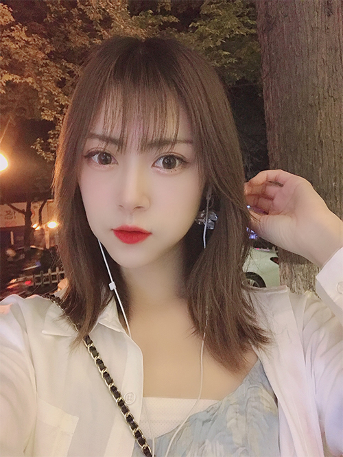 天津伊美爾超肋鼻綜合案例兩個(gè)月后效果圖