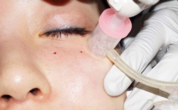 水光針和皮秒哪個(gè)好？