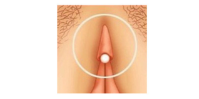 陰蒂整形術術后