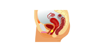 G點(diǎn)注射術(shù)后