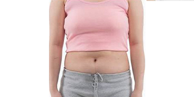 超聲溶脂瘦腹部術前