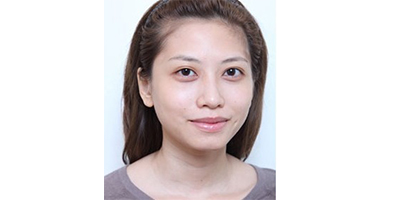 玻尿酸墊下巴術前