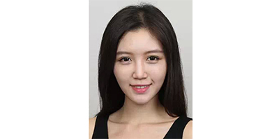 玻尿酸豐蘋果肌術(shù)后