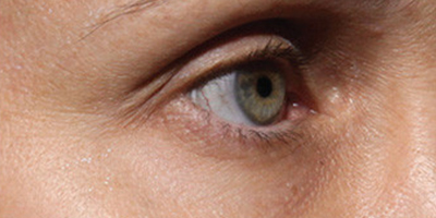 菲洛嘉術(shù)后