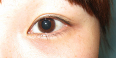 半永久紋眼線術(shù)前