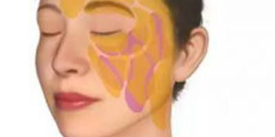 自體脂肪存儲(chǔ)術(shù)前