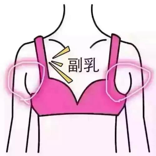 吸脂做副乳要多少錢？吸脂去副乳會(huì)反彈嗎？