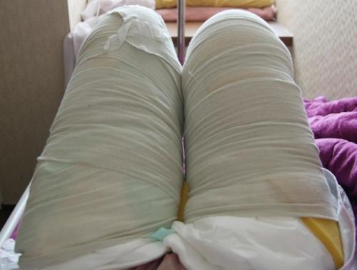 射頻溶脂瘦大腿一次有用嗎 射頻溶脂瘦大腿多久有效果 射頻溶脂瘦大腿一次有用嗎 射頻溶脂瘦大腿多久有效果